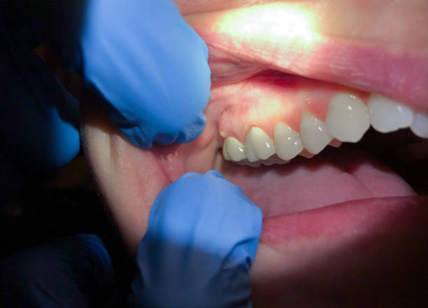 Best Walk-In Dentist Near Me  in Longtown, OK