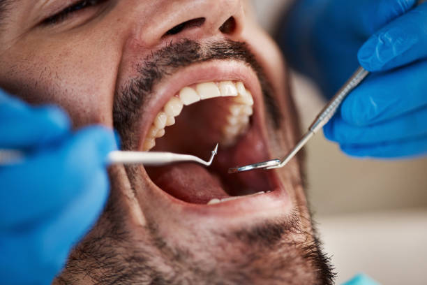 Best Tooth Infection Emergency Dentist  in Longtown, OK