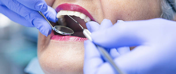 Best Teeth Whitening  in Longtown, OK